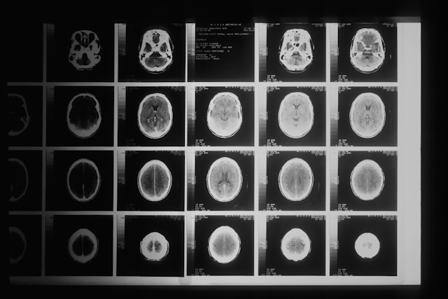brain-scan-image